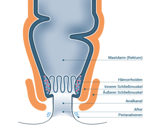 HÄMORRHOIDEN SIND NICHTS SCHLIMMES UND BEI JEDEM MENSCHEN VON GEBURT AN VORHANDEN